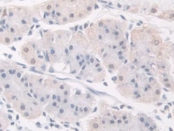 Invitrogen FKBP4 Polyclonal Antibody 20 &mu;L; Unconjugated:Antibodies,