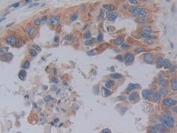 Invitrogen FKBP7 Polyclonal Antibody:Antibodies:Primary Antibodies