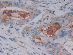 Invitrogen FKBP7 Polyclonal Antibody:Antibodies:Primary Antibodies