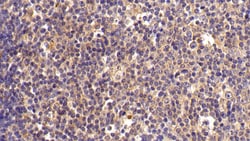 Invitrogen FKBP7 Polyclonal Antibody:Antibodies:Primary Antibodies