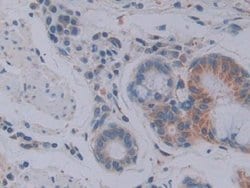 Invitrogen FKBP7 Polyclonal Antibody:Antibodies:Primary Antibodies