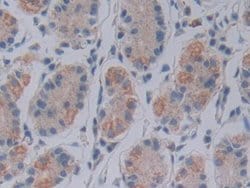 Invitrogen FKBP7 Polyclonal Antibody:Antibodies:Primary Antibodies