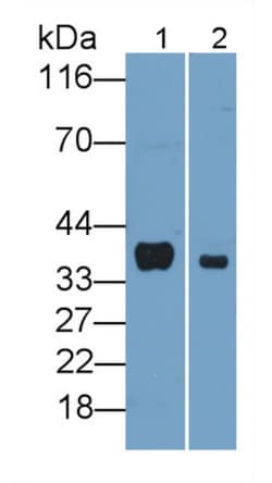 Invitrogen FKBP7 Polyclonal Antibody:Antibodies:Primary Antibodies