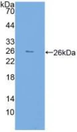 Invitrogen FKBP7 Polyclonal Antibody:Antibodies:Primary Antibodies