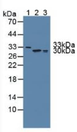 Invitrogen FKBP7 Polyclonal Antibody:Antibodies:Primary Antibodies