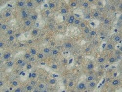 Invitrogen FAK Polyclonal Antibody:Antibodies:Primary Antibodies