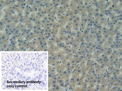 Invitrogen FAK Polyclonal Antibody 20 &mu;L; Unconjugated:Antibodies, Polyclonal