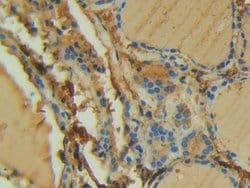 Invitrogen FAK Polyclonal Antibody:Antibodies:Primary Antibodies