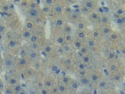 Invitrogen FAK Polyclonal Antibody:Antibodies:Primary Antibodies