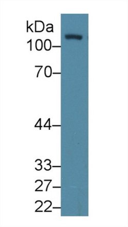 Invitrogen FAK Polyclonal Antibody:Antibodies:Primary Antibodies