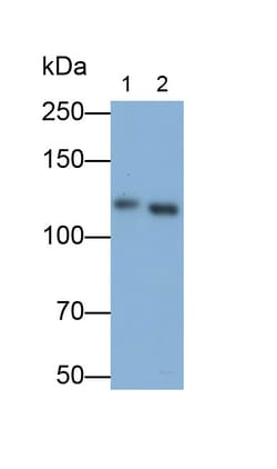 Invitrogen FAK Polyclonal Antibody 20 &mu;L; Unconjugated:Antibodies, Polyclonal