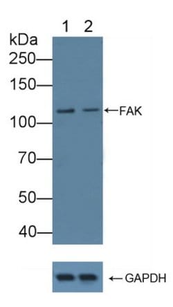 Invitrogen FAK Polyclonal Antibody:Antibodies:Primary Antibodies