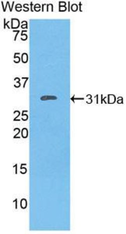 Invitrogen FAK Polyclonal Antibody:Antibodies:Primary Antibodies