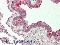Invitrogen FOLR1 Polyclonal Antibody 200 &mu;L; Unconjugated:Antibodies,