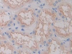Invitrogen FOLR1 Polyclonal Antibody 200 &mu;L; Unconjugated:Antibodies,