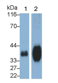 Invitrogen FOLR1 Polyclonal Antibody 20 &mu;L | Buy Online | Invitrogen&trade; | Fisher Scientific