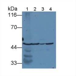 Invitrogen Fumarase Polyclonal Antibody 200 &mu;L; Unconjugated:Antibodies,