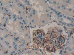 Invitrogen Galectin 1 Polyclonal Antibody 200 &mu;L; Unconjugated:Antibodies,