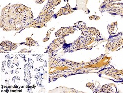 Invitrogen Galectin 1 Polyclonal Antibody 20 &mu;L; Unconjugated:Antibodies,