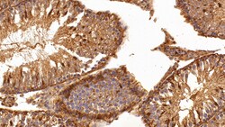 Invitrogen Galectin 1 Polyclonal Antibody 20 &mu;L; Unconjugated:Antibodies,