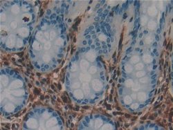 Invitrogen Galectin 1 Polyclonal Antibody 200 &mu;L; Unconjugated:Antibodies,