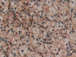 Invitrogen Galectin 1 Polyclonal Antibody 200 &mu;L; Unconjugated:Antibodies,