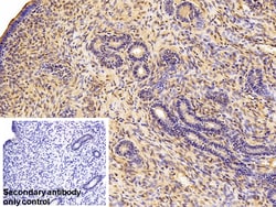 Invitrogen Galectin 1 Polyclonal Antibody 20 &mu;L; Unconjugated:Antibodies,
