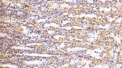 Invitrogen Galectin 1 Polyclonal Antibody 20 &mu;L; Unconjugated:Antibodies,