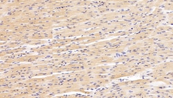 Invitrogen Galectin 1 Polyclonal Antibody 20 &mu;L; Unconjugated:Antibodies,