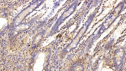 Invitrogen Galectin 1 Polyclonal Antibody 20 &mu;L; Unconjugated:Antibodies,