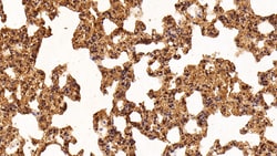 Invitrogen Galectin 1 Polyclonal Antibody 20 &mu;L; Unconjugated:Antibodies,