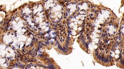 Invitrogen Galectin 1 Polyclonal Antibody 20 &mu;L; Unconjugated:Antibodies,