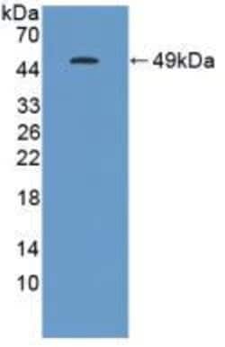Invitrogen GKN1 Polyclonal Antibody 200 &mu;L; Unconjugated:Antibodies,
