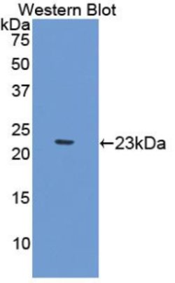 Invitrogen Gastrokine 2 Polyclonal Antibody 200 &mu;L; Unconjugated:Antibodies,