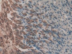 Invitrogen Gastrokine 2 Polyclonal Antibody 200 &mu;L; Unconjugated:Antibodies,