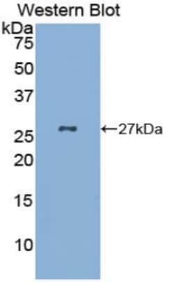 Invitrogen Gastrokine 2 Polyclonal Antibody 200 &mu;L; Unconjugated:Antibodies,