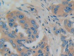Invitrogen GDI1 Polyclonal Antibody:Antibodies:Primary Antibodies
