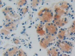 Invitrogen GDI1 Polyclonal Antibody:Antibodies:Primary Antibodies
