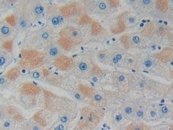 Invitrogen GDI1 Polyclonal Antibody:Antibodies:Primary Antibodies