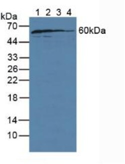 Invitrogen GDI1 Polyclonal Antibody:Antibodies:Primary Antibodies