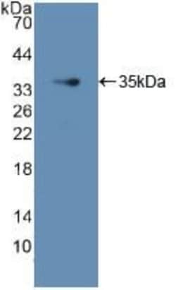 Invitrogen GDI1 Polyclonal Antibody:Antibodies:Primary Antibodies