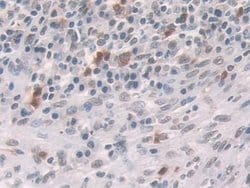 Invitrogen Glucocorticoid Receptor Polyclonal Antibody 20 &mu;L; Unconjugated:Antibodies,