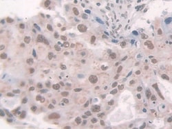 Invitrogen Glucocorticoid Receptor Polyclonal Antibody:Antibodies:Primary