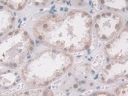 Invitrogen Glucocorticoid Receptor Polyclonal Antibody 20 &mu;L; Unconjugated:Antibodies,
