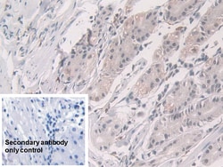 Invitrogen Glucocorticoid Receptor Polyclonal Antibody:Antibodies:Primary