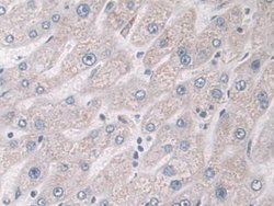 Invitrogen Glucocorticoid Receptor Polyclonal Antibody 20 &mu;L; Unconjugated:Antibodies,