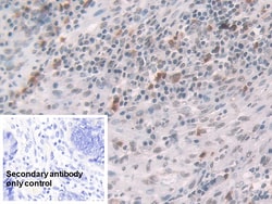 Invitrogen Glucocorticoid Receptor Polyclonal Antibody:Antibodies:Primary