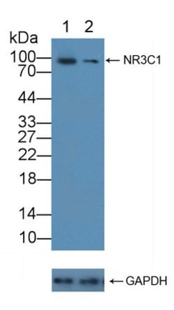 Invitrogen Glucocorticoid Receptor Polyclonal Antibody 20 &mu;L; Unconjugated:Antibodies,