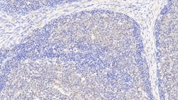 Invitrogen G6PD Polyclonal Antibody:Antibodies:Primary Antibodies