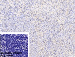 Invitrogen G6PD Polyclonal Antibody:Antibodies:Primary Antibodies